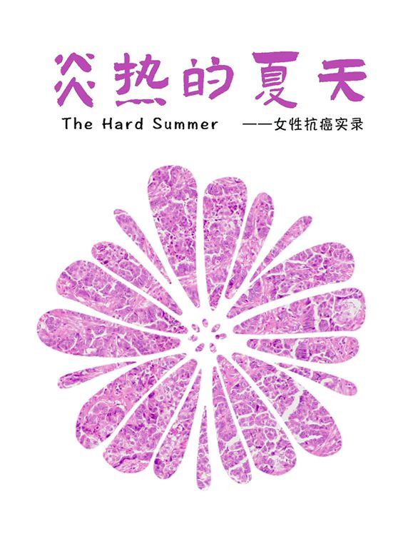 疯狂的石头